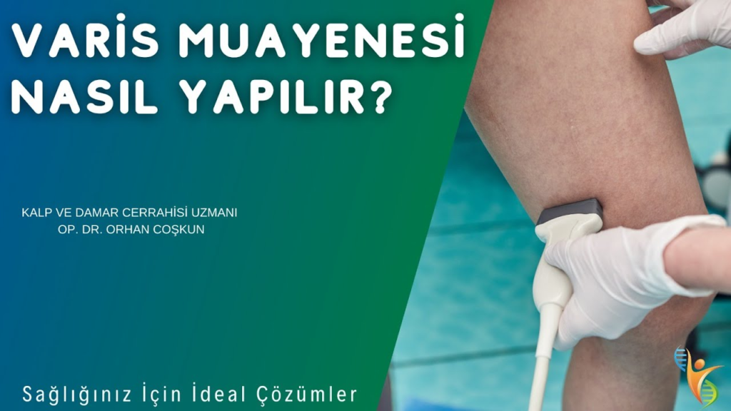 Ameliyatsız Varis Tedavi Yöntemleri Güncel Bilgiler